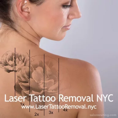 Laser Tattoo Removal NYC, New York City - Photo 3