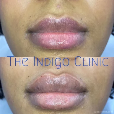 The Indigo Clinic, New York City - Photo 8