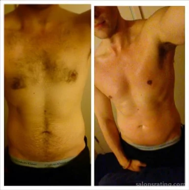 MPM Body Hair Removal Studio exclusively for Men, New York City - Photo 2