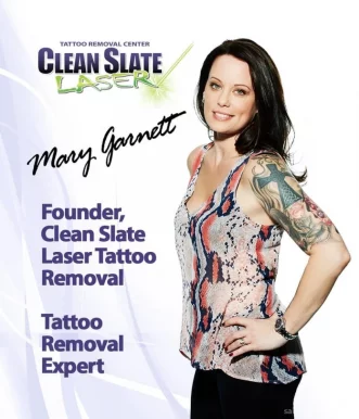Clean Slate Laser Tattoo Removal, New York City - Photo 3