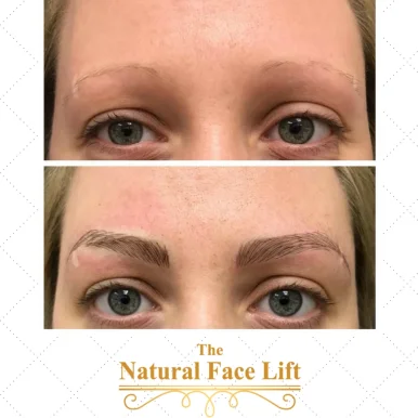 The Natural Face Lift With Michelle Larson, LMT, New York City - Photo 4