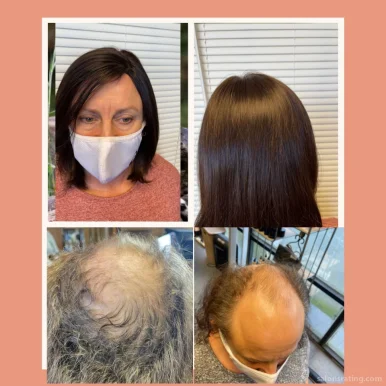 Restore Hair Now / Hair Replacement Center, Pearland - Photo 3