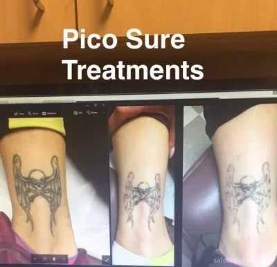Phoenix Tattoo Removal and Skin Revitalization, Phoenix - Photo 1