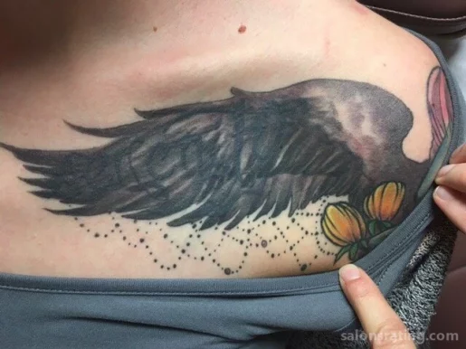 Phoenix Tattoo Removal and Skin Revitalization, Phoenix - Photo 6