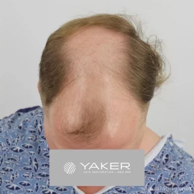 YAKER Hair Restoration + Med Spa (Joseph R. Yaker, MD), Plano - Photo 4