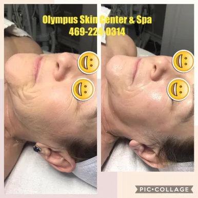 Olympus Skin Center & Spa, Plano - Photo 2