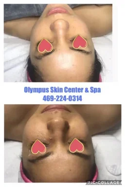 Olympus Skin Center & Spa, Plano - Photo 1
