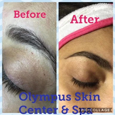 Olympus Skin Center & Spa, Plano - Photo 8