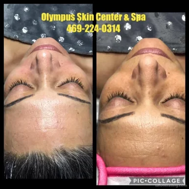 Olympus Skin Center & Spa, Plano - Photo 6