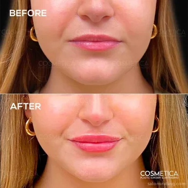 Cosmetica Plastic Surgery & Anti-Aging, Port St. Lucie - Photo 6