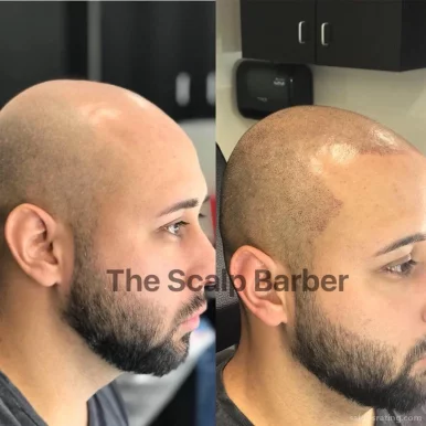 The Scalp Barber Scalp Micropigmentation Hair Loss Solution By Allure, Sacramento - Photo 4