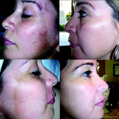 Skin Rejuvenation Clinique, San Antonio - Photo 7