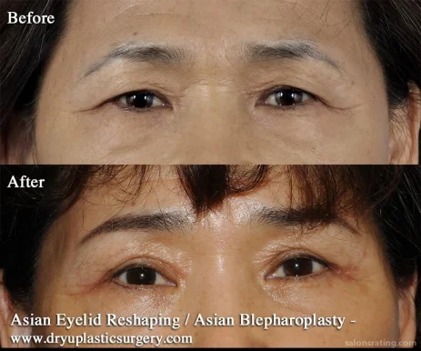Dr. Kenneth Yu Facial Plastic & Reconstructive Surgery, San Antonio - Photo 3