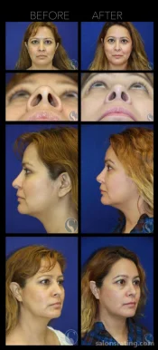 Stallworth Facial Plastic Surgery, San Antonio - Photo 5