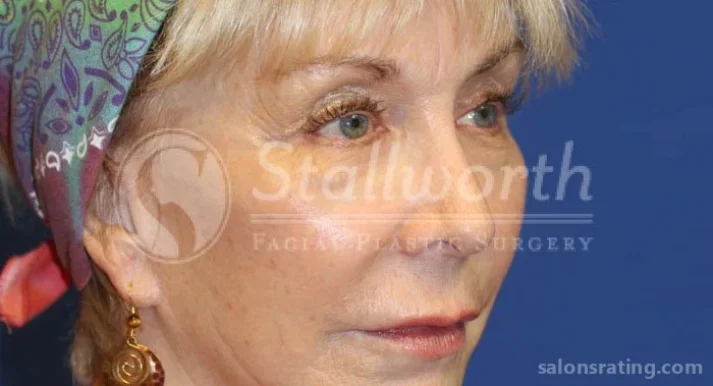 Stallworth Facial Plastic Surgery, San Antonio - Photo 1