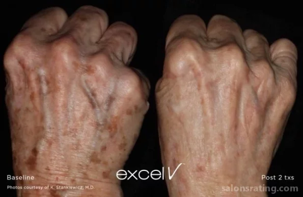 Skin by Design Dermatology & Laser Center, PA, San Antonio - Photo 1