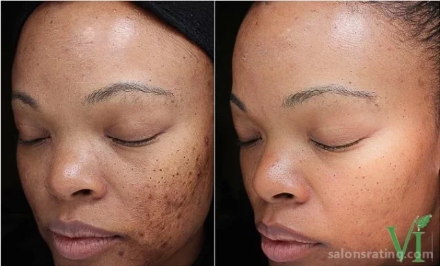Skin by Design Dermatology & Laser Center, PA, San Antonio - Photo 8