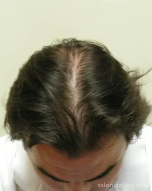 Laser Hair Regeneration.com, San Diego - Photo 2