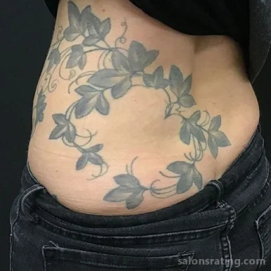 Removery Tattoo Removal & Fading, Sandy Springs - Photo 1