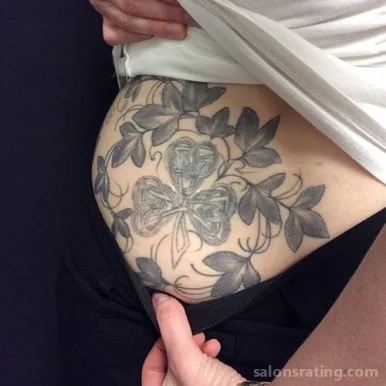Removery Tattoo Removal & Fading, Sandy Springs - Photo 3