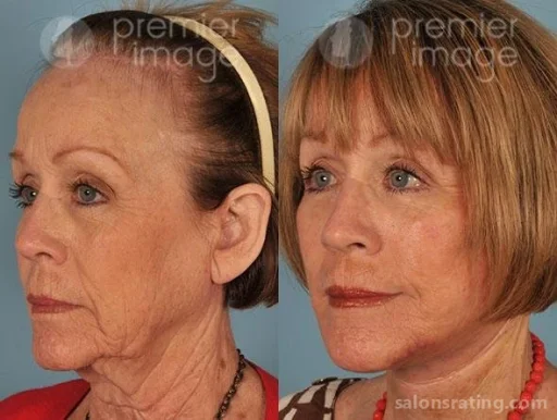 Premier Image Cosmetic & Laser Surgery, Sandy Springs - Photo 3
