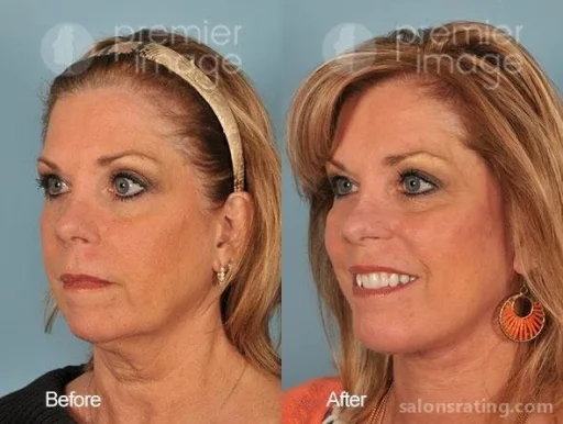 Premier Image Cosmetic & Laser Surgery, Sandy Springs - Photo 2
