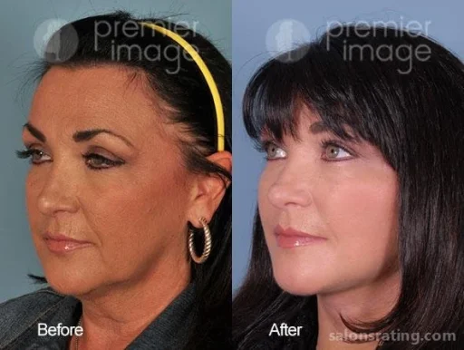 Premier Image Cosmetic & Laser Surgery, Sandy Springs - Photo 7