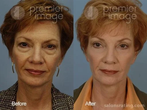 Premier Image Cosmetic & Laser Surgery, Sandy Springs - Photo 4