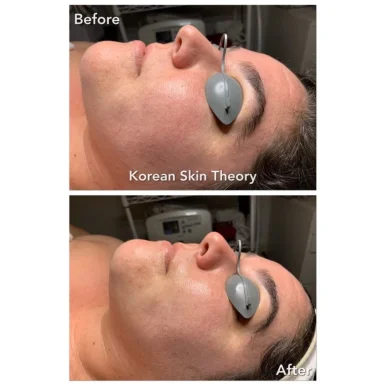 Korean Skin Theory, San Jose - Photo 7