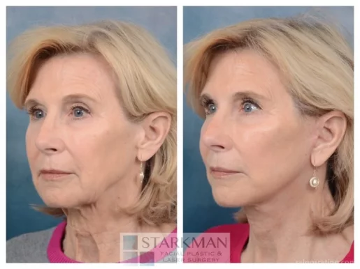 Starkman Facial Plastic & Laser Surgery, Scottsdale - Photo 2