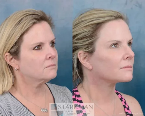 Starkman Facial Plastic & Laser Surgery, Scottsdale - Photo 6