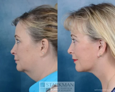 Starkman Facial Plastic & Laser Surgery, Scottsdale - Photo 1