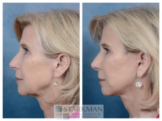 Starkman Facial Plastic & Laser Surgery, Scottsdale - Photo 4