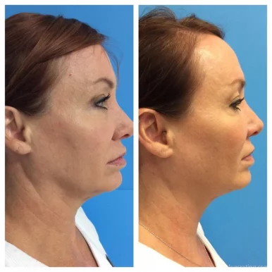 Medical Esthetics and Laser Skin Care by Melinda McAlees, Tampa - Photo 6
