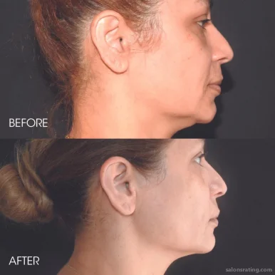 Ultimate Image Cosmetic Medical Center Tampa, Tampa - Photo 3