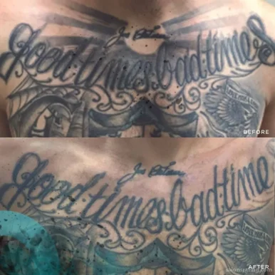 Removery Tattoo Removal & Fading, Tampa - Photo 7