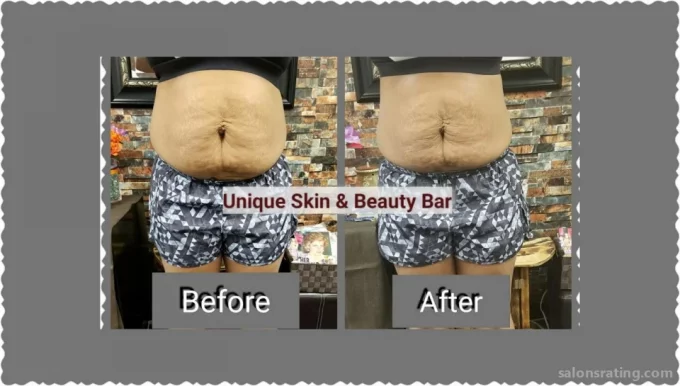 Unique Skin & Beauty Bar, Virginia Beach - Photo 3