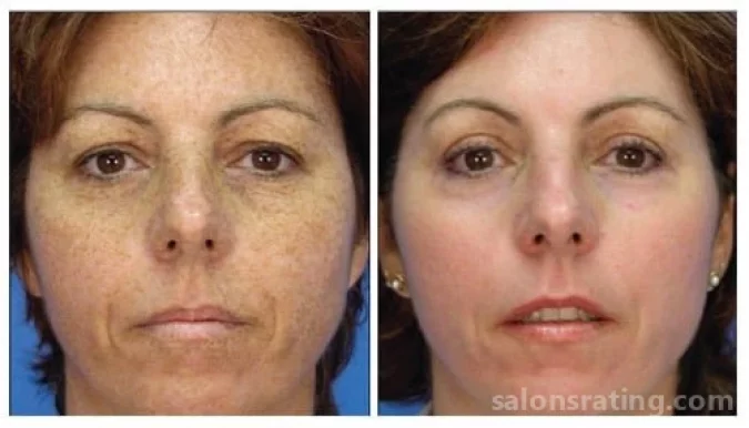 Washington Facial Plastic Surgery and Rejuvenation Center, Washington - Photo 2