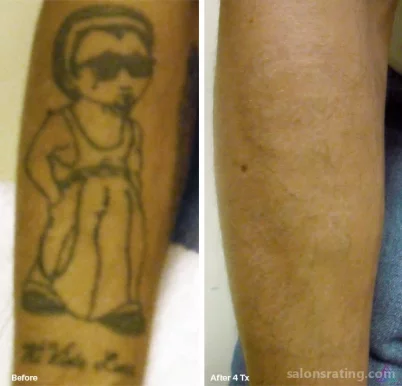 Evicted Ink Laser Tattoo Removal, Wichita - Photo 1